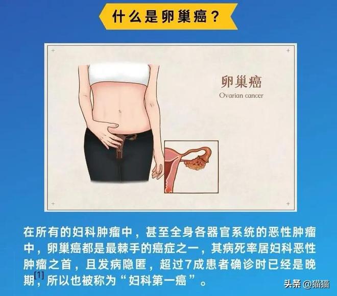 称为妇科肿瘤“死亡率第一杀手”的癌症pg电子平台朱媛媛病因曝光是一种被(图2)
